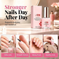💅 Wzmacniacz do miękkich paznokci – 50% ZNIŻKI! KUP 1 → 1 GRATIS! OFERTA LIMITOWANA! Wzmacnia, odżywia i chroni miękkie, łamliwe i niedoskonałe paznokcie. Szybko działająca formuła, widoczne efekty już po kilku dniach. ✨💖